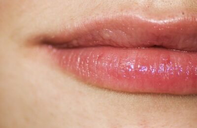 Kamille gegen Pickel und Mitesser