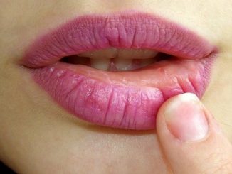 Treten im Mundbereich Spannungsgefühle oder ein unangenehmes Kribbeln auf, kündigt sich der nächste Herpesausbruch an. - Foto: pixabay.com/AdinaVoicu/CCO